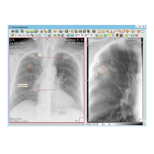 АПК «АрхиМед»