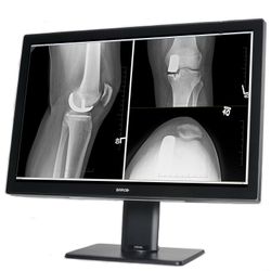 Coronis Fusion 4MP MDCC-4430