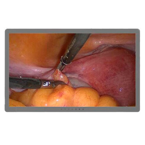 Хирургический дисплей