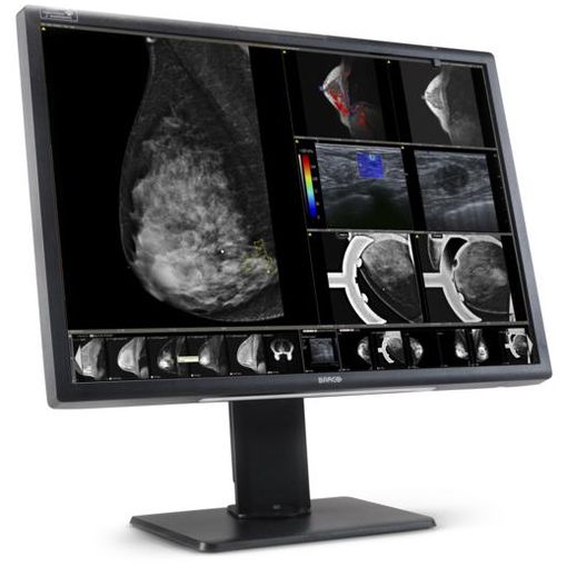 Nio Fusion 12MP MDNC-12130