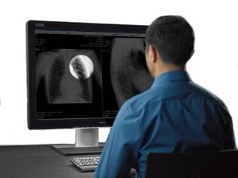 Coronis Uniti MDMC-12133