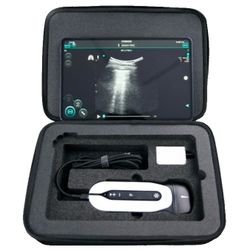 SonoTouch 30 (SonoEye)