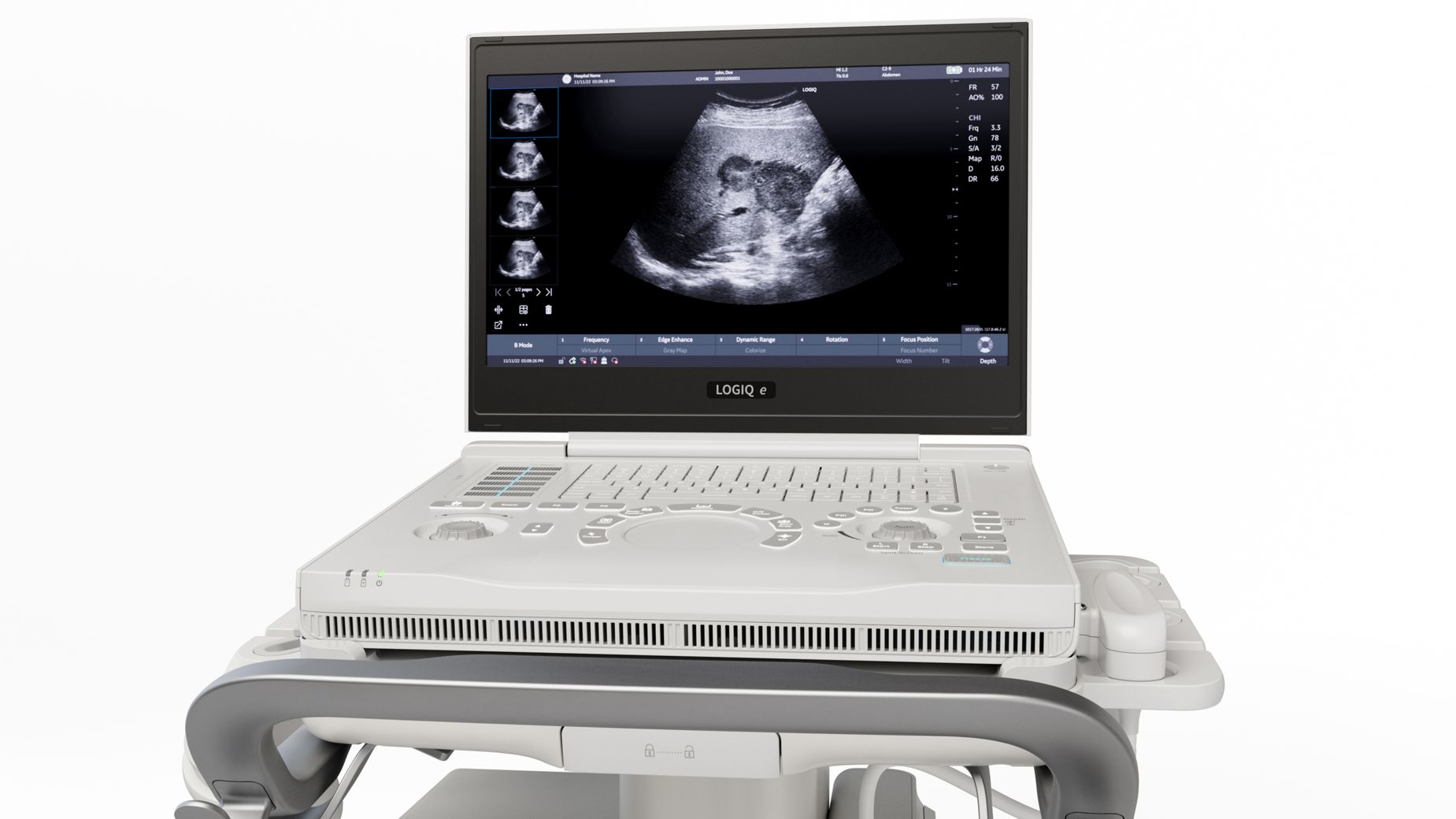 Ge Logiq R R9 Купить GE Logiq e R9 по лучшей цене у официального поставщика