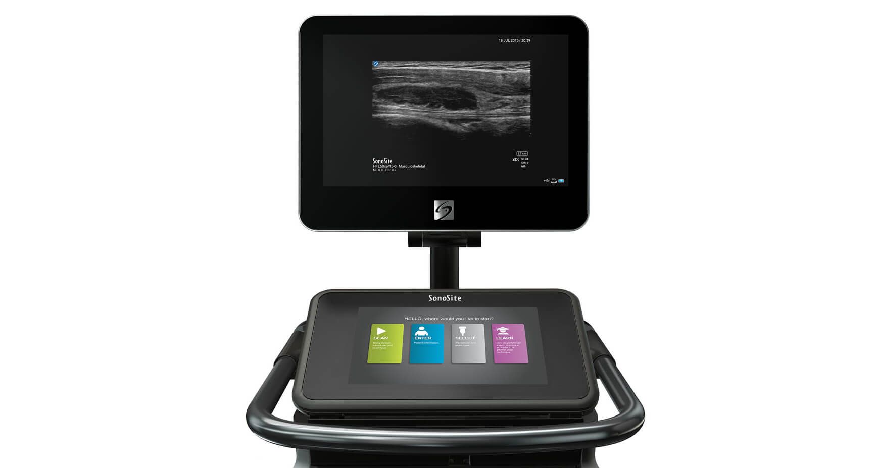 Fujifilm SonoSite объявило о выпуске УЗИ сканера с технологией Point-of-care