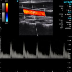 SonoTouch 30 (SonoEye)