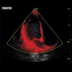 УЗИ-средний класс