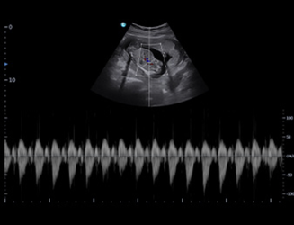 SonoTouch 50 (SonoAir)