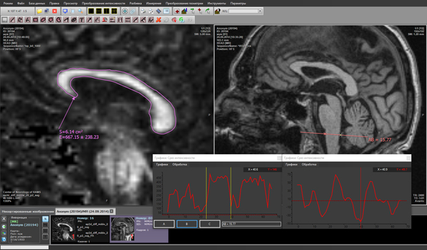 АРМ врача-диагноста "Гамма Мультивокс Д1"