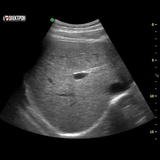 УЗИ-экспертный класс