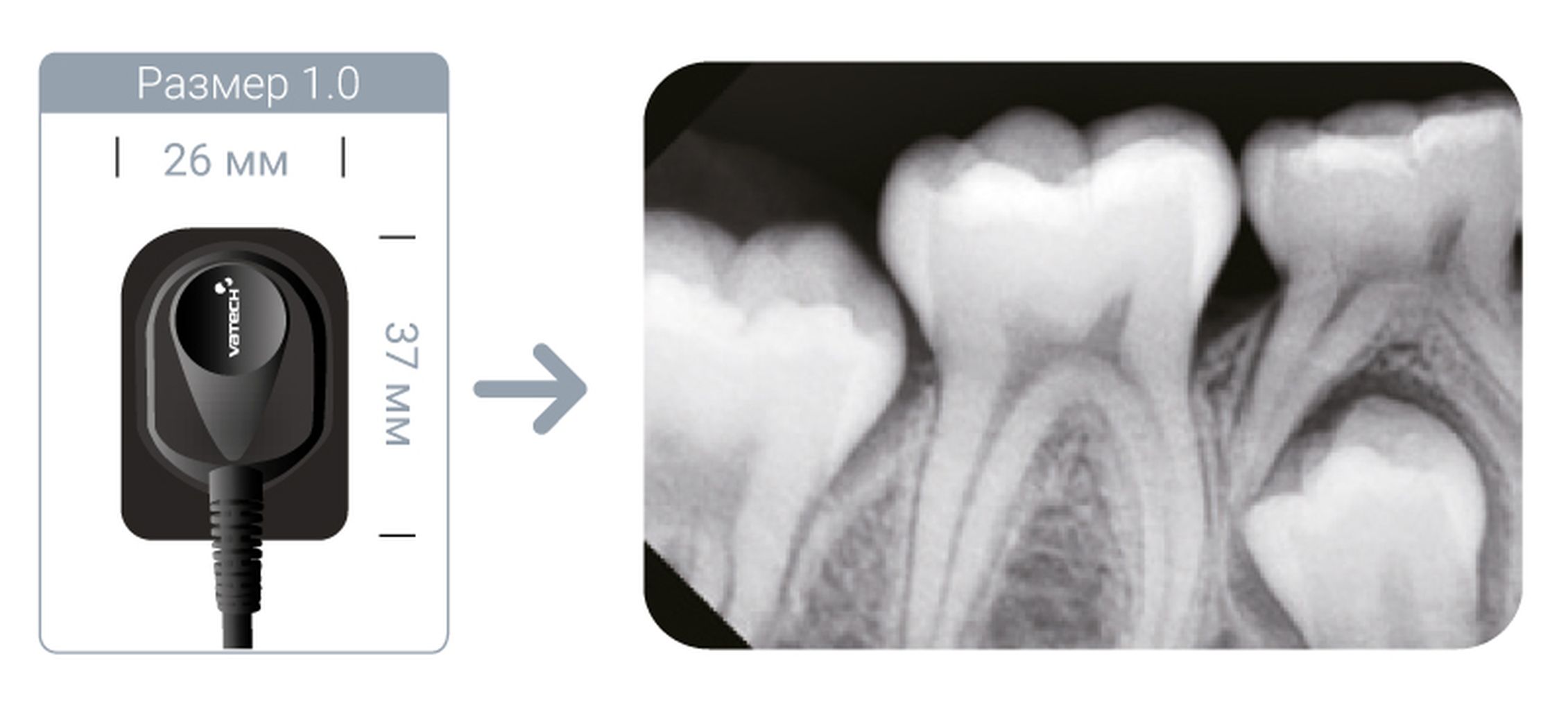 Радиовизиограф vatech. Радиовизиограф VATECH EZSENSOR размер 1.5. VATECH EZSENSOR радиовизиограф. Визиограф в стоматологии Ватеч. Датчик размер для визиографа.