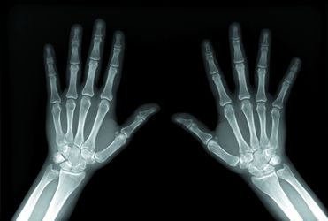 Цифровые аппараты с мобильным столом