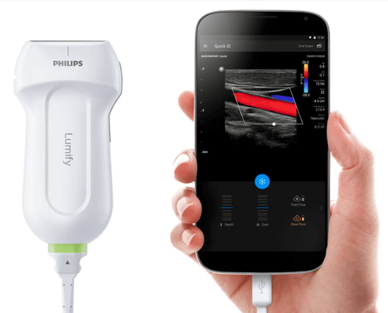 Устройства филипс. Philips Lumify УЗИ. Система ультразвуковая портативная Lumify. Портативный УЗИ аппарат Philips Lumify. Lumify l12-4.