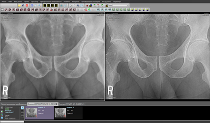АРМ врача-диагноста "Гамма Мультивокс Д1"