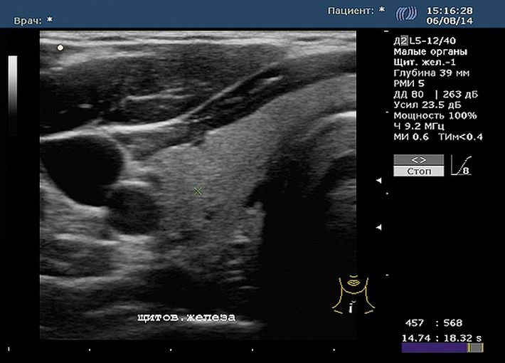 Соно/П-Ультра