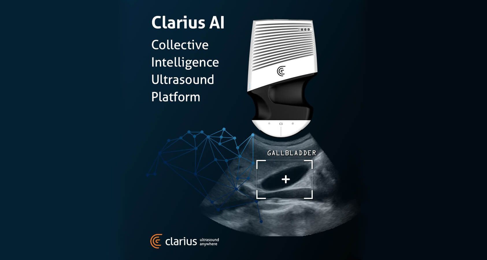 Clarius Mobile Health объявляет о выпуске платформы Clarius AI