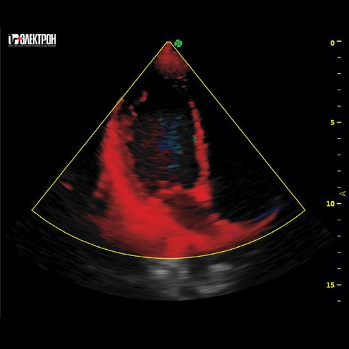 УЗИ-средний класс
