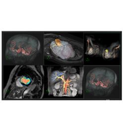 60″ Professional LCD