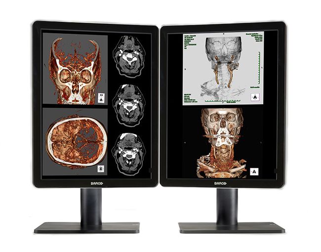 Nio Color 2MP LED MDNC-2221