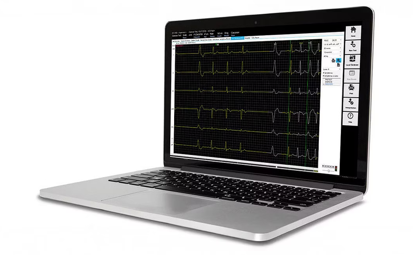 Стресс-система GE HealthСare CardioSoft, изображение 3