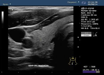 Соно/П-Ультра