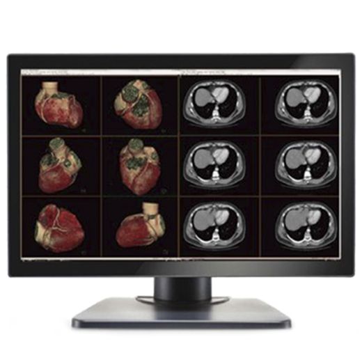 Image Systems Gemini 6MP Large Format Display