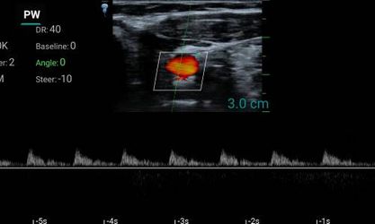 10SE (линейный)