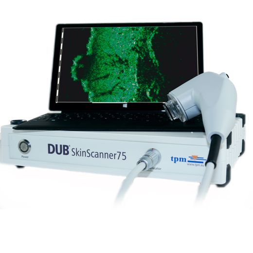DUB (Digital Ultrasound Imaging System)