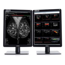 Nio Color 5MP MDNC-6121