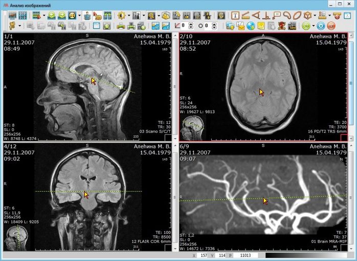 АПК «АрхиМед»