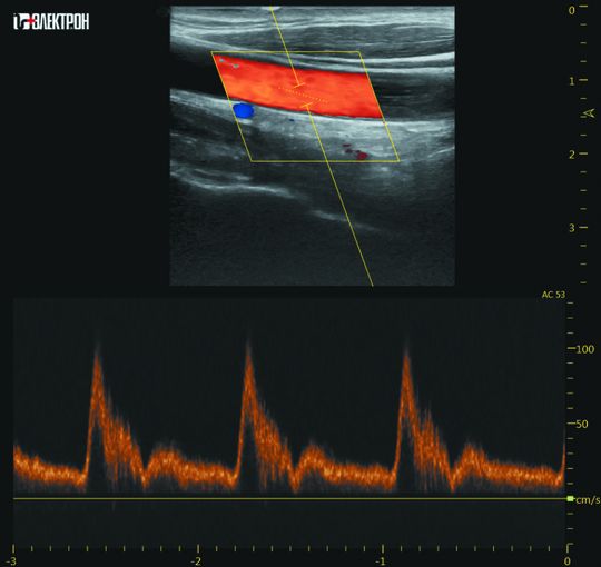 УЗИ-средний класс