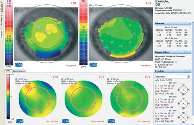 Combi wavefront analyzer