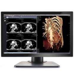 Image Systems Gemini 4MP Large Format Display