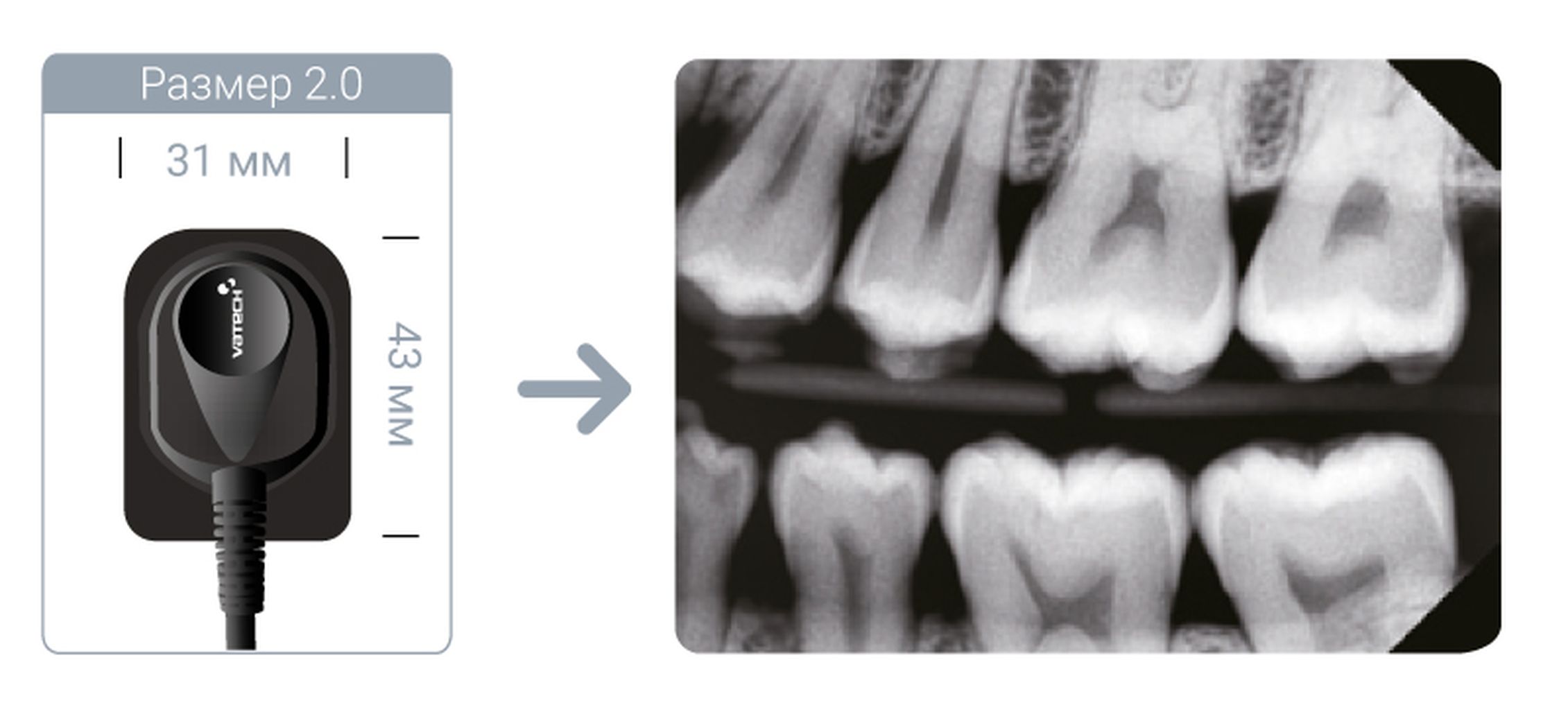 Радиовизиограф vatech. Радиовизиограф VATECH EZSENSOR размер 1.5. Интраоральный визиограф EZSENSOR 1.5. VATECH EZSENSOR снимки. Аппарат радиовизиографический EZSENSOR С принадлежностями, VATECH 1.5 Корея).