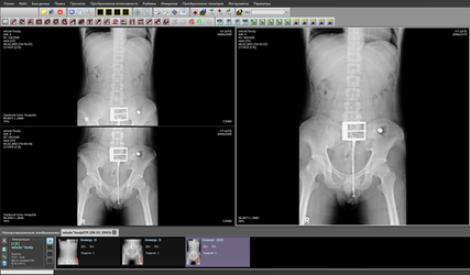 АРМ врача-диагноста "Гамма Мультивокс Д1"