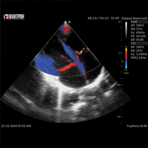 УЗИ-экспертный класс