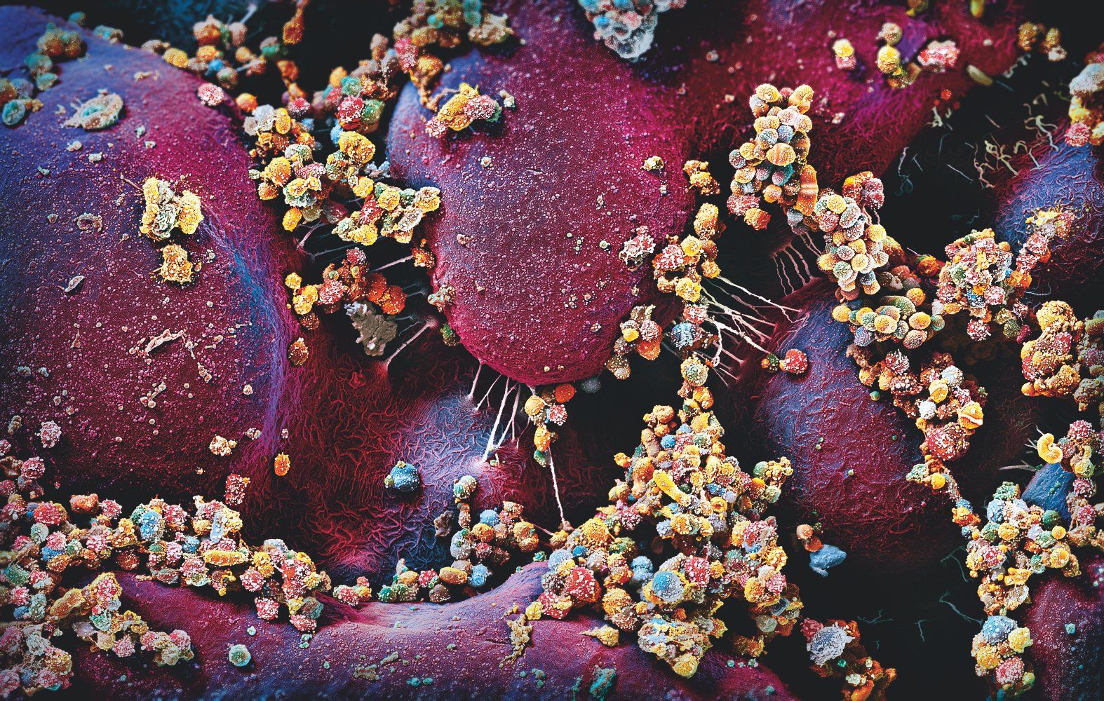 Микробиом человека: как на нас влияет многомиллиардный зоопарк микробов