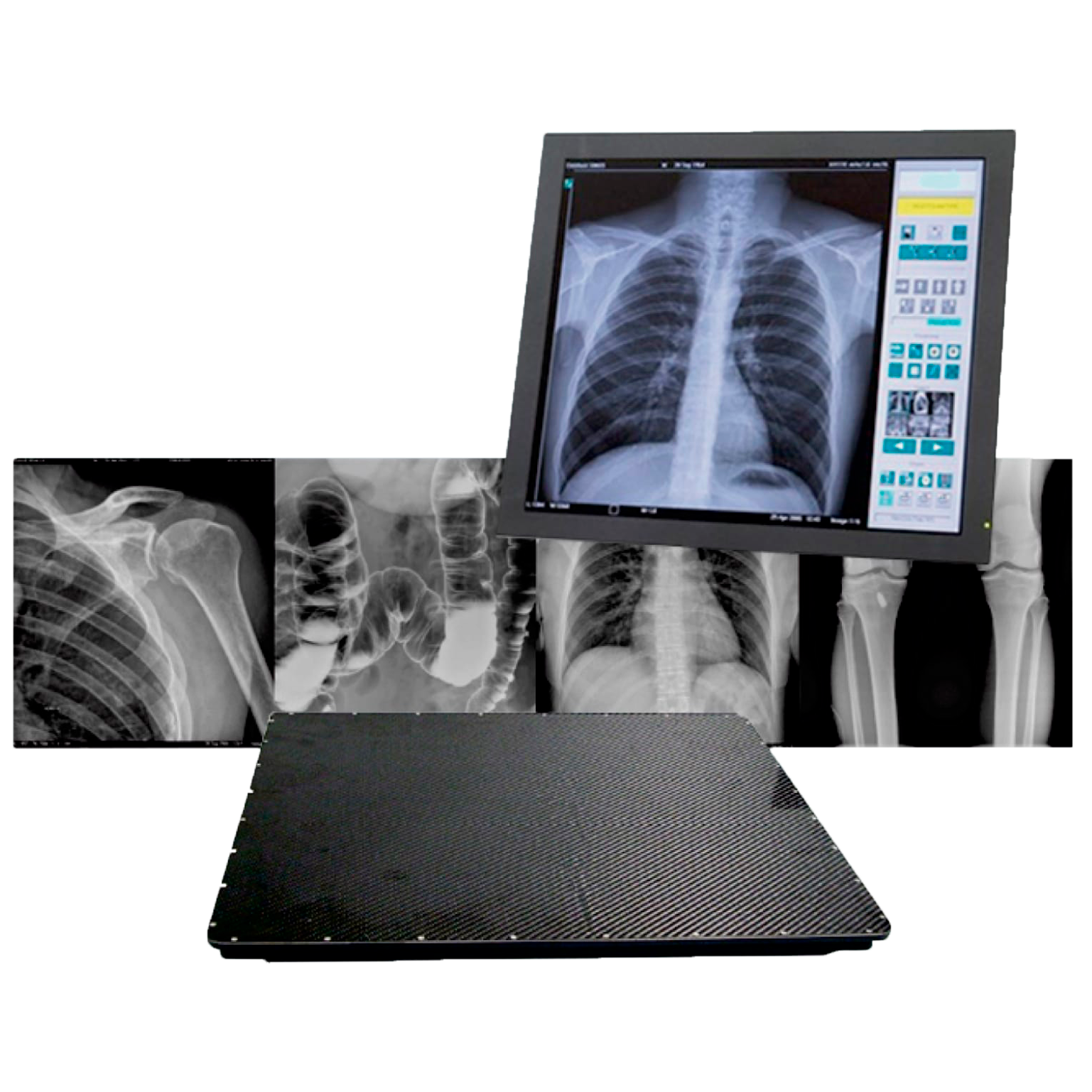 Цифровой рентген-детектор. Электрорентгенография аппарат. Digital x-ray Detector(PIXXGEN/pixx-1717)/цифровой рентген. Pcm50us15 плоскопанельный детектор.