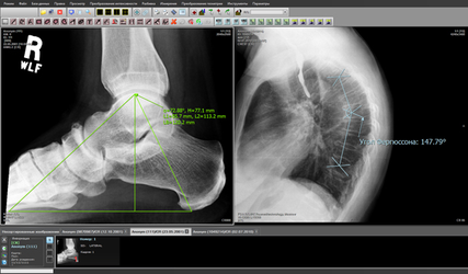 АРМ врача-диагноста "Гамма Мультивокс Д1"