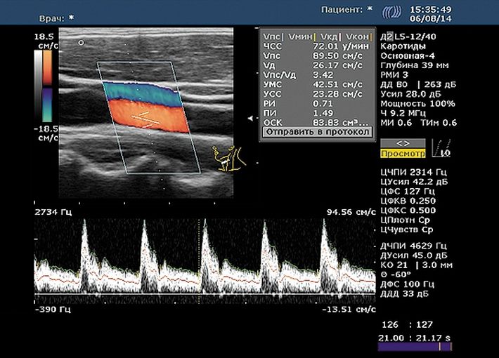 Соно/П-Ультра