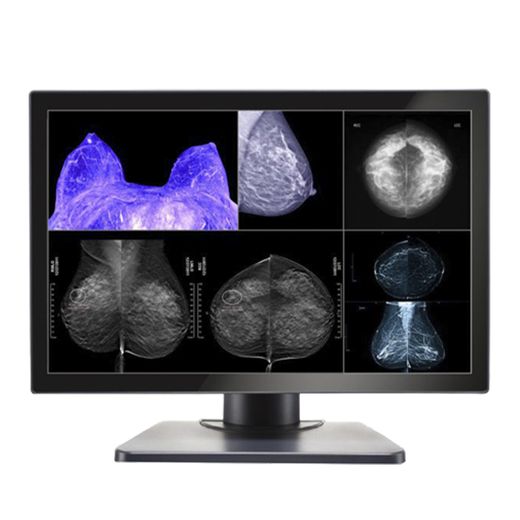 Image Systems Gemini Series 8MP Large Format Display