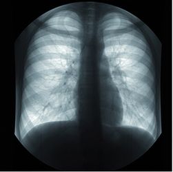 Аналоговые аппараты на 2 и 3 рабочих места