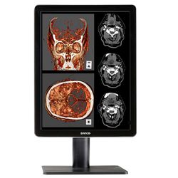 Nio Color 2MP LED MDNC-2221