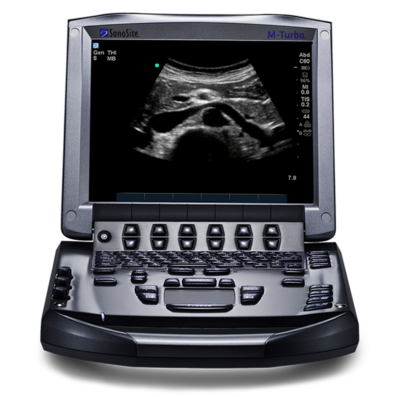 Узи системы. Ультразвуковой аппарат sonosite m-Turbo. УЗИ Fujifilm sonosite. M-Turbo Ultrasound System. Аппарат УЗИ Fujifilm sonosite m-Turbo SN:wk1m3j.