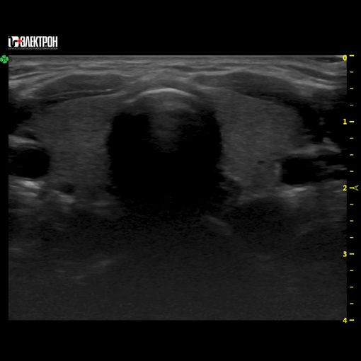 УЗИ-средний класс