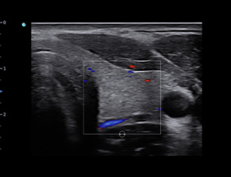 SonoTouch 50 (SonoAir)