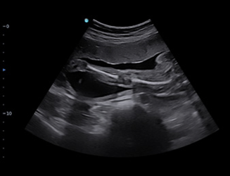 SonoTouch 50 (SonoAir)