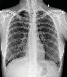 Гамма 2 рабочих места