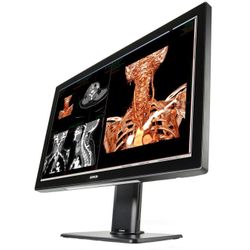 Coronis Fusion 6MP MDCC-6530