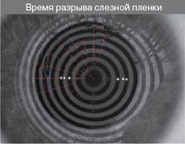 время разрыва слёзной плёнки