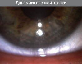 динамика слёзной плёнки